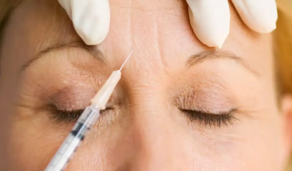 Botox para eliminar arrugas y suavizar entrecejo