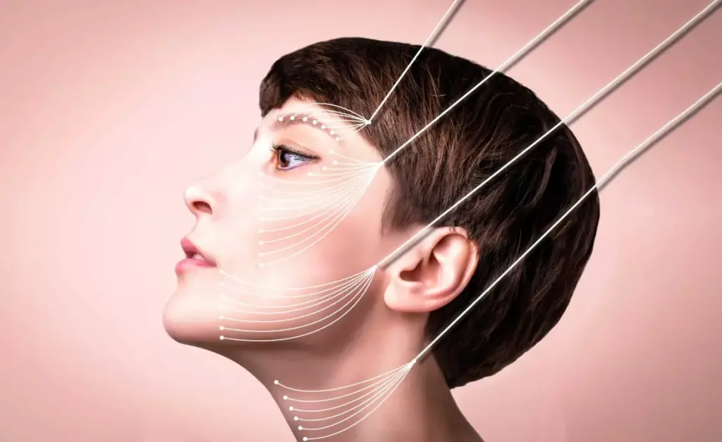 Hilos lisos PDO para lifting facial sin cirugía